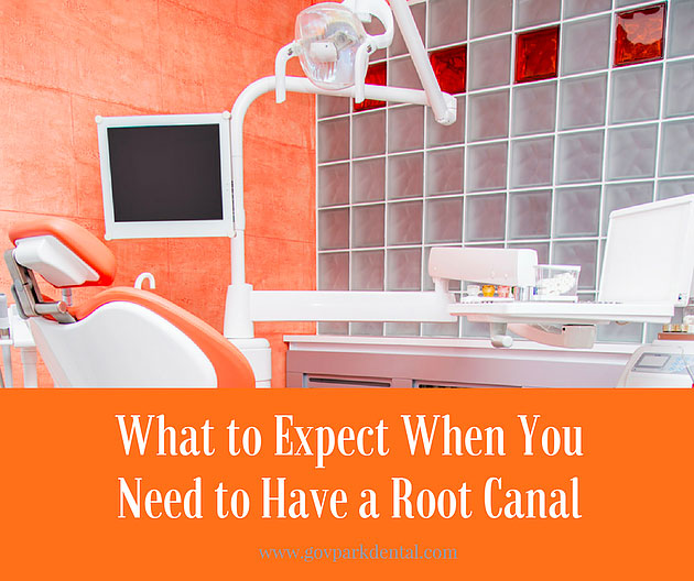What to Expect in Root Canal