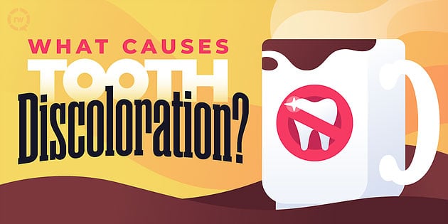 Causes of Tooth Discoloration